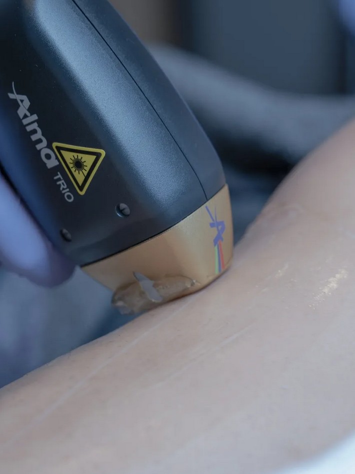 High End | longevity reisen zaabeel treatment laser