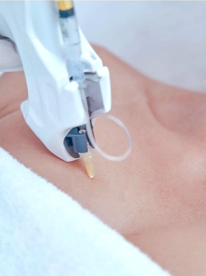 dubai | longevity reisen zaabeel treatment mesotherapy