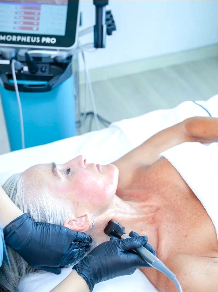 High End | longevity reisen zaabeelmicroneedling